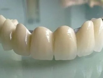 哪种情况比较适合做烤瓷牙？