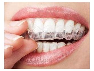 哪种情况不适合做牙齿矫正？